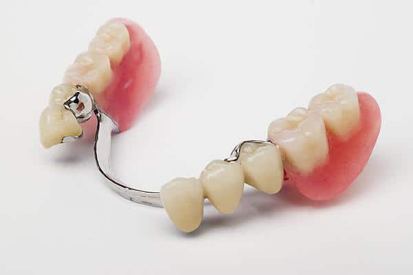 Partial Lower Chrome Denture