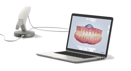 3D intraoral scanner