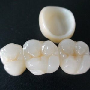 Zirconia Crown inside external surface and fitting surface